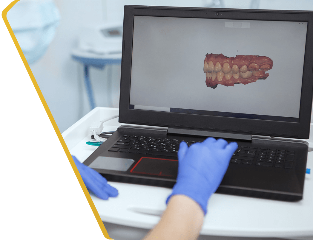 A 3D Full Mouth Health Scan on screen at Dentistry at Millennium Park in Chicago