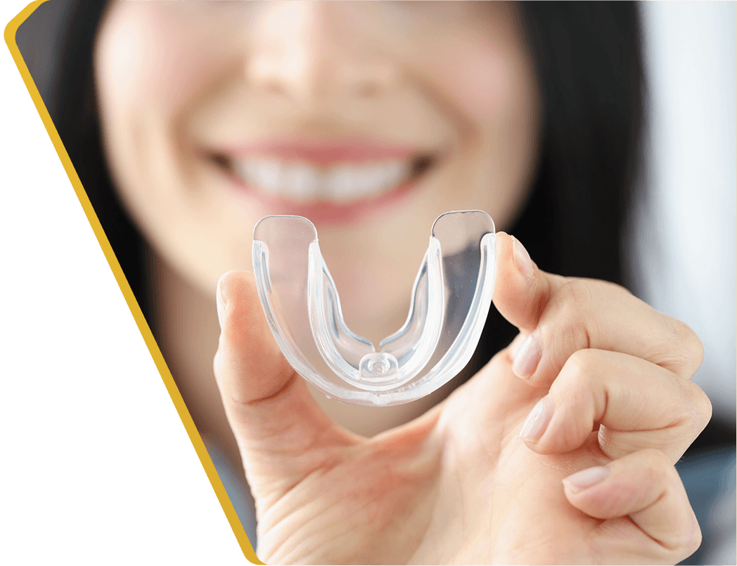 A custom nightguard made to protect teeth from grinding at Dentistry at Millennium Park in Chicago