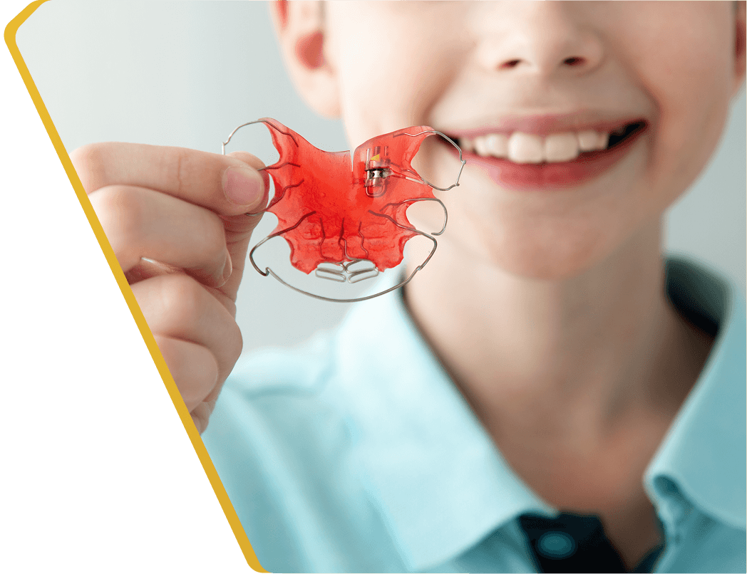 A patient holding a clear custom retainer at Dentistry at Millennium Park in Chicago