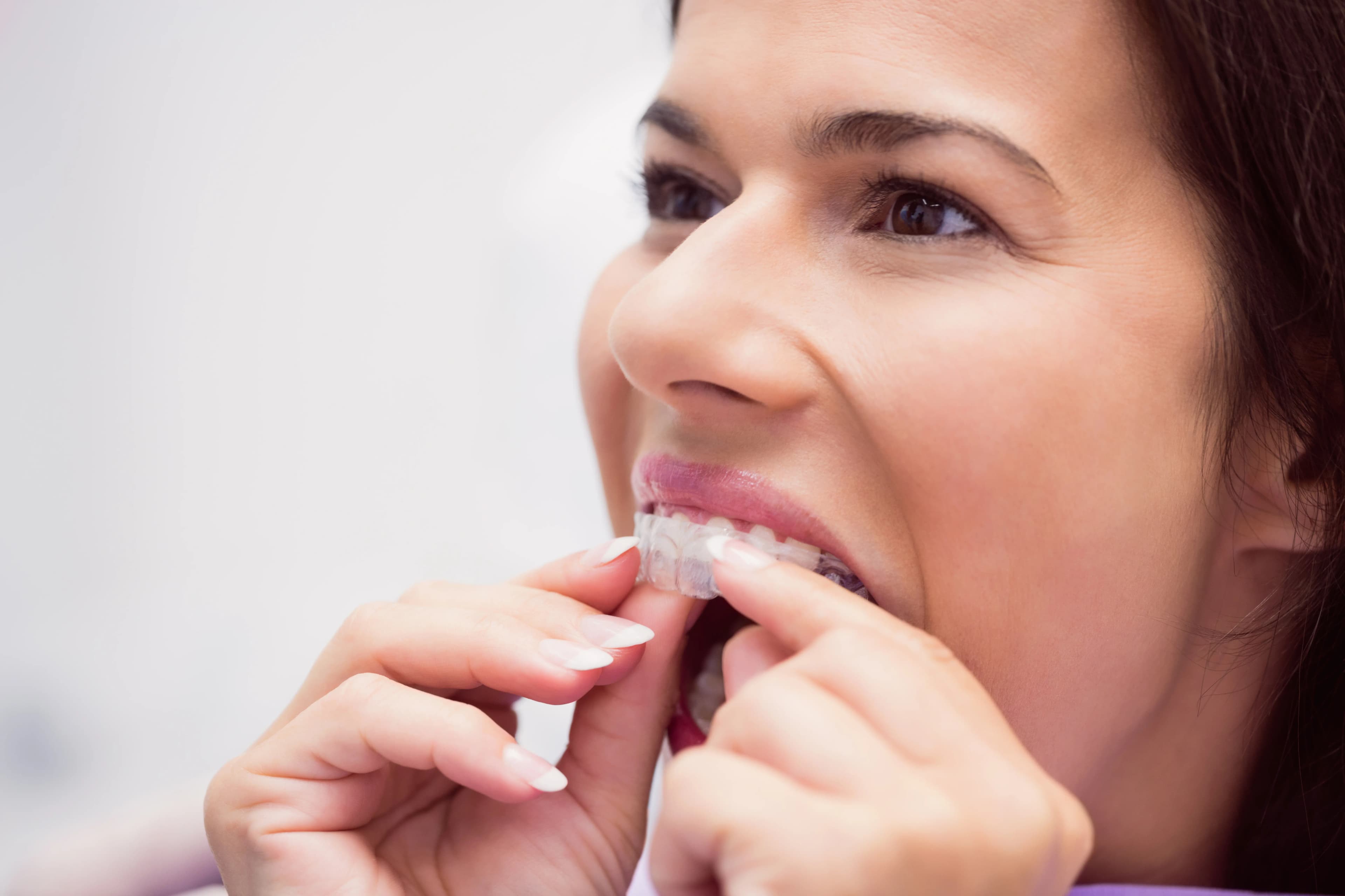 A patient holding a clear aligner tray and smiling at Dentistry at Millennium Park in Chicago