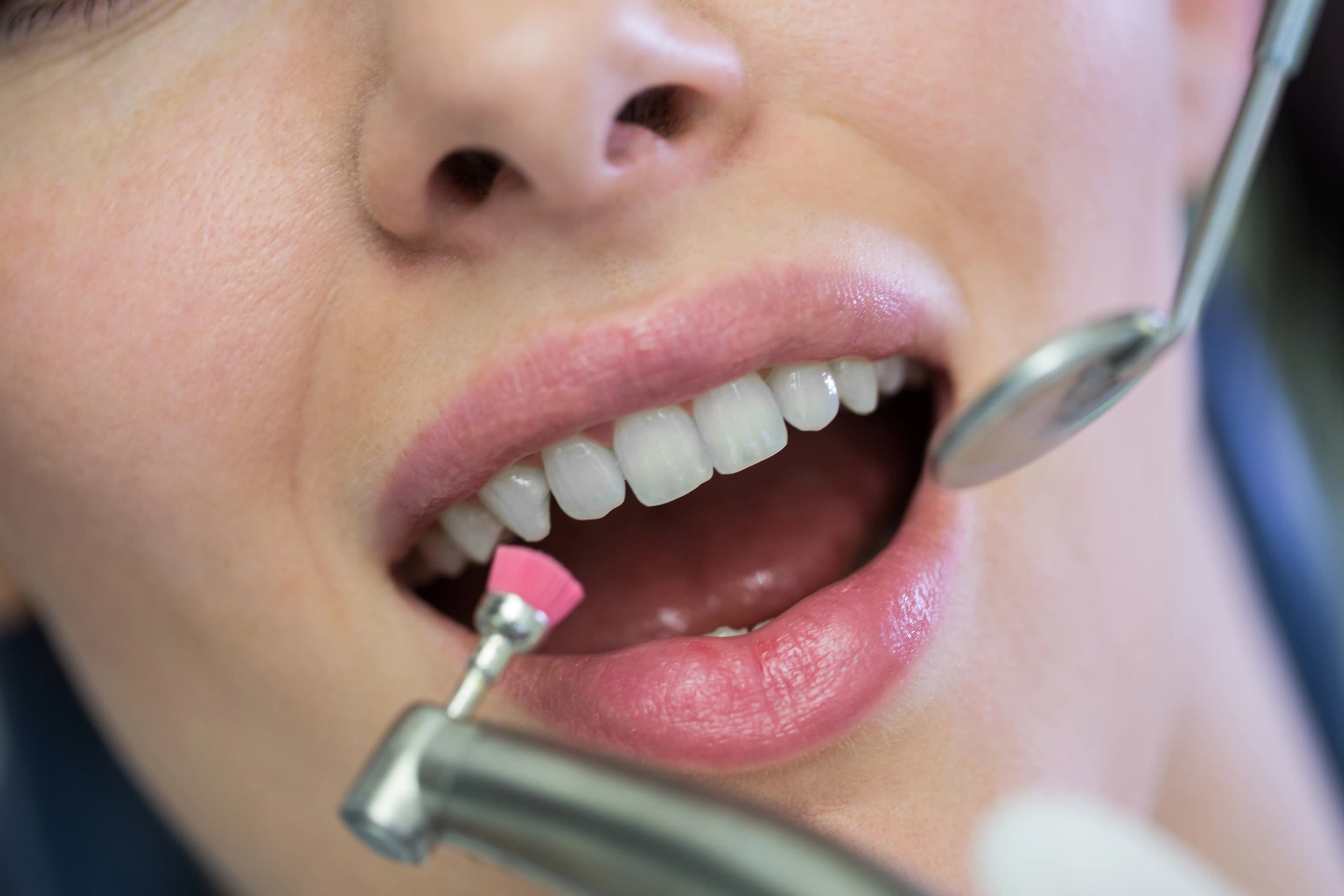 A patient receiving a quick fluoride treatment at Dentistry at Millennium Park in Chicago