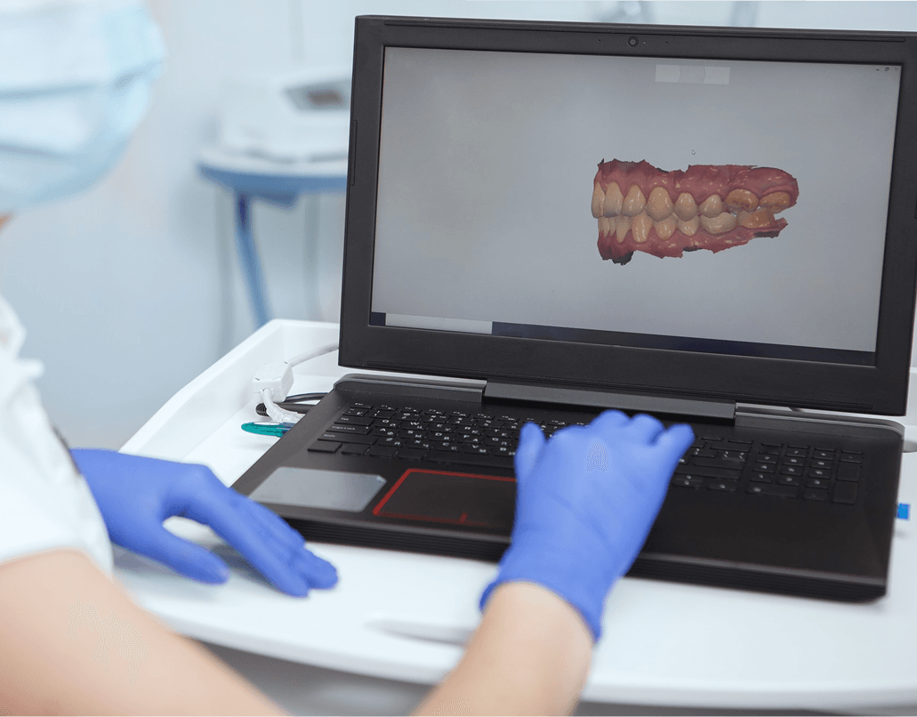 A 3D Full Mouth Health Scan on screen at Dentistry at Millennium Park in Chicago
