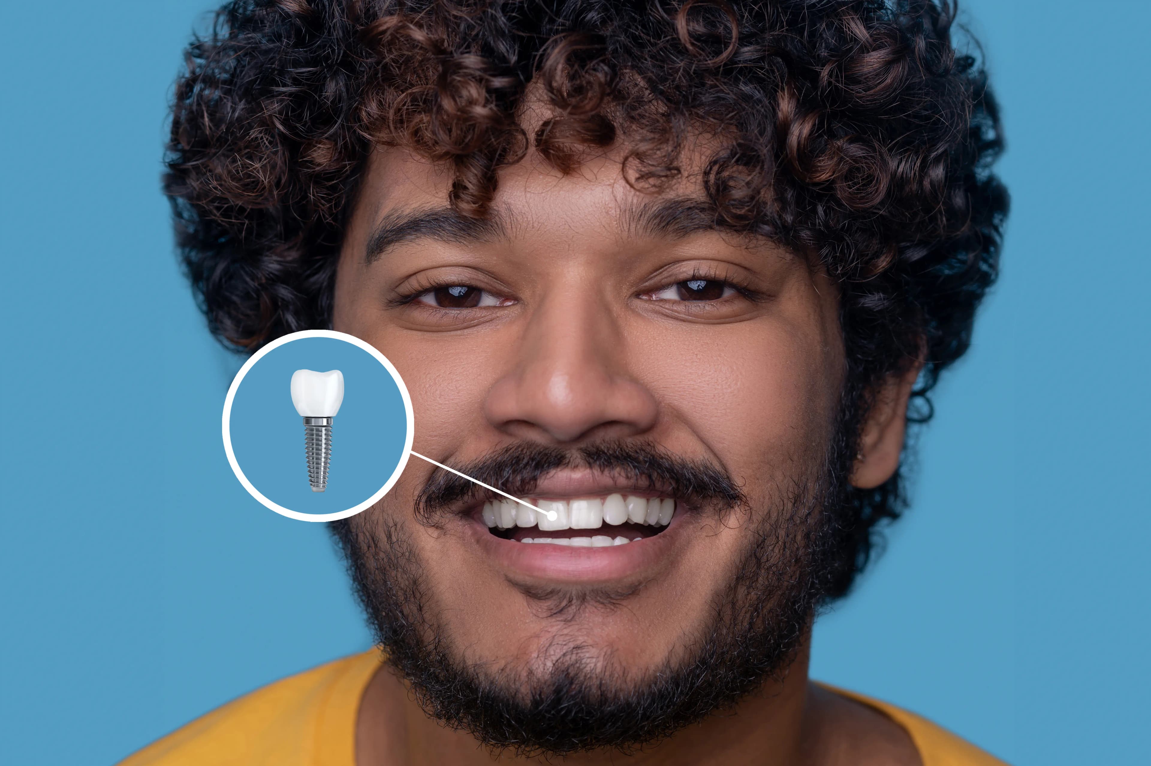 A patient's complete smile after a dental implant restoration at Dentistry at Millennium Park in Chicago