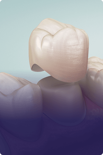 Dental Crowns