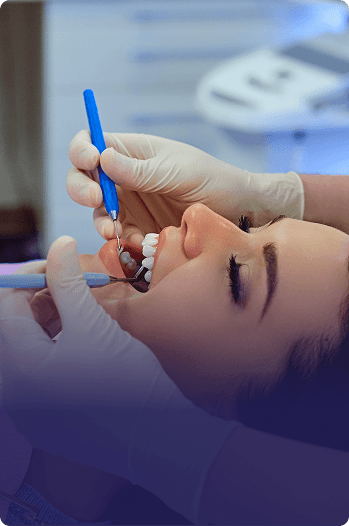 Dental Fillings