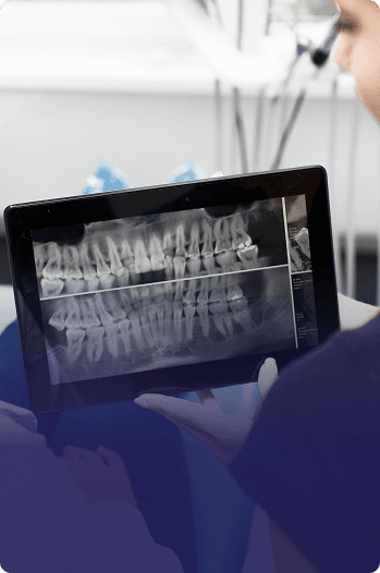 Digital X-Rays