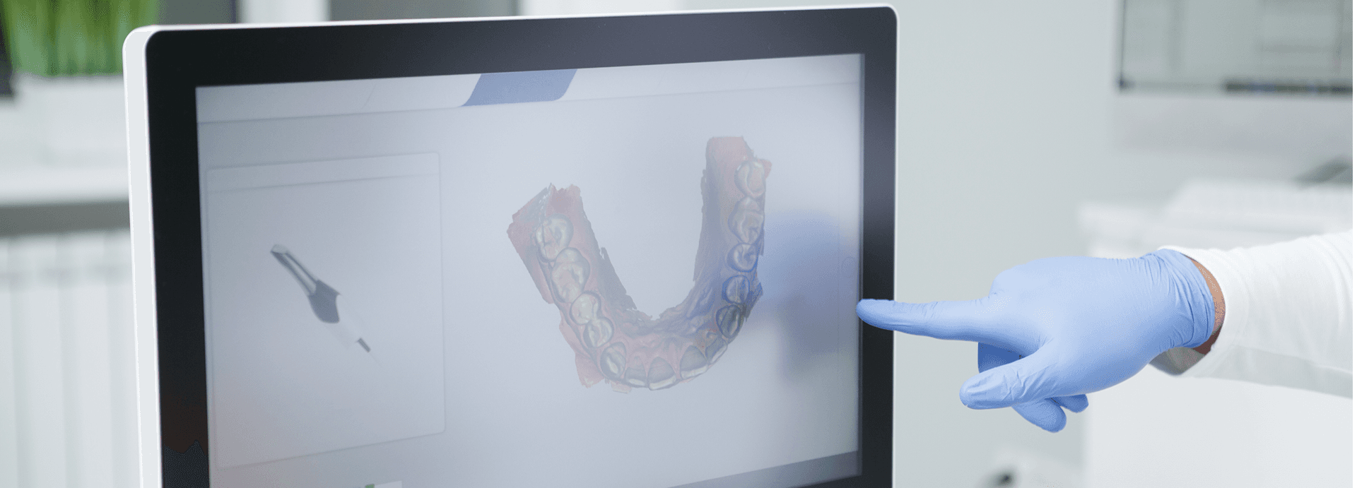 Smile improvement consultation
