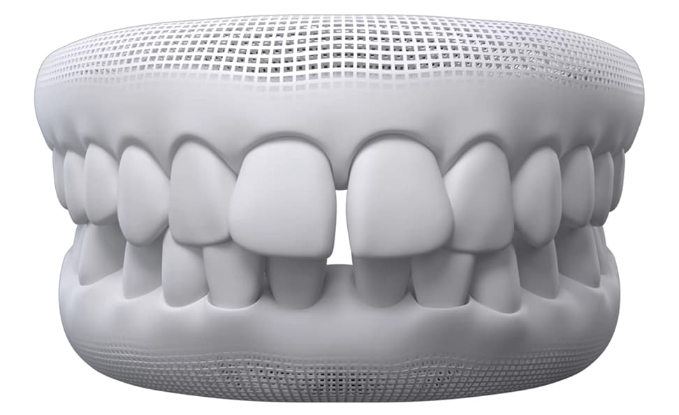 Gap Teeth dental model