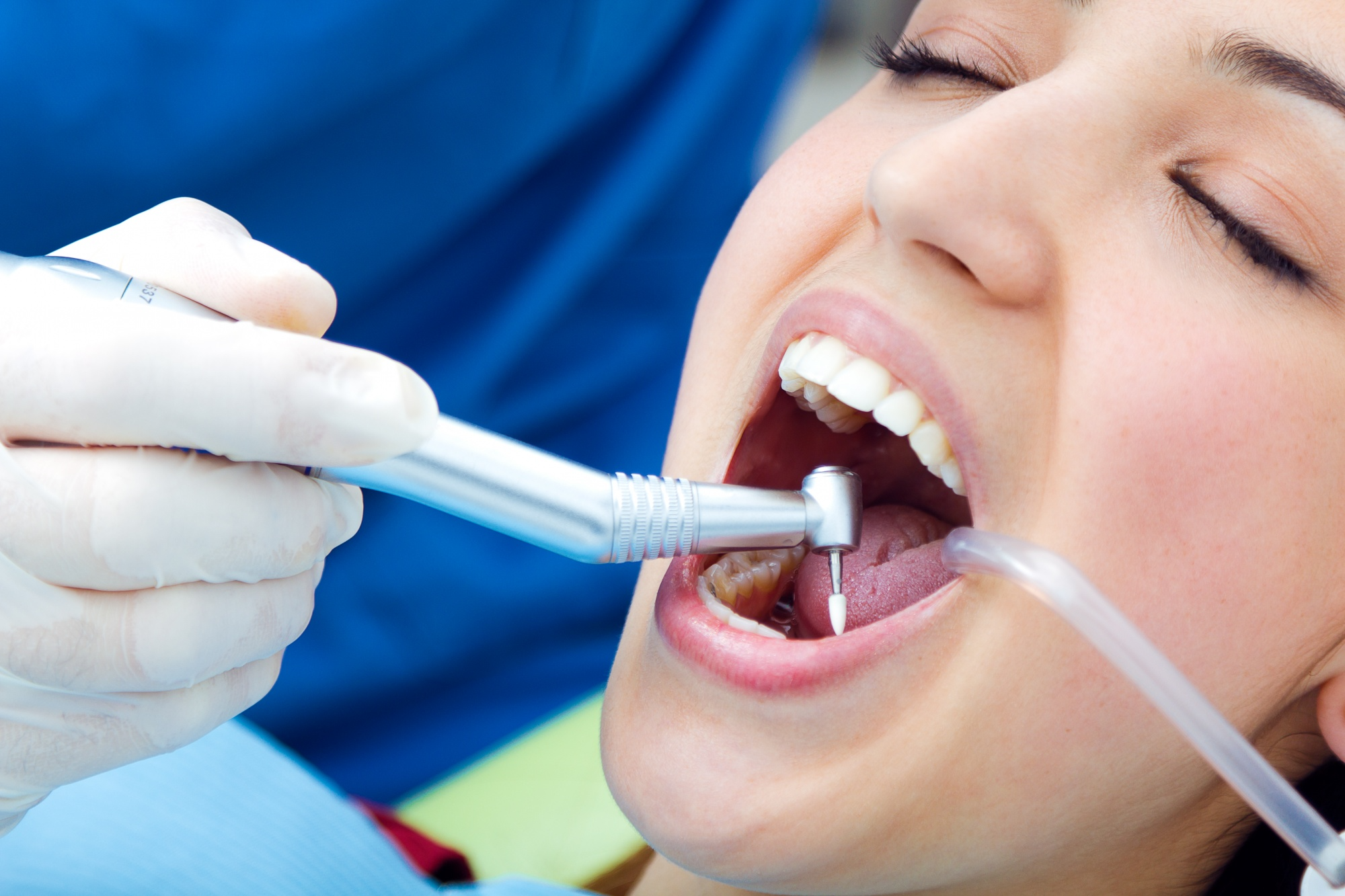 A natural-looking dental crown restoring a tooth
