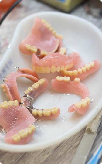 A natural-looking partial denture replacing missing teeth