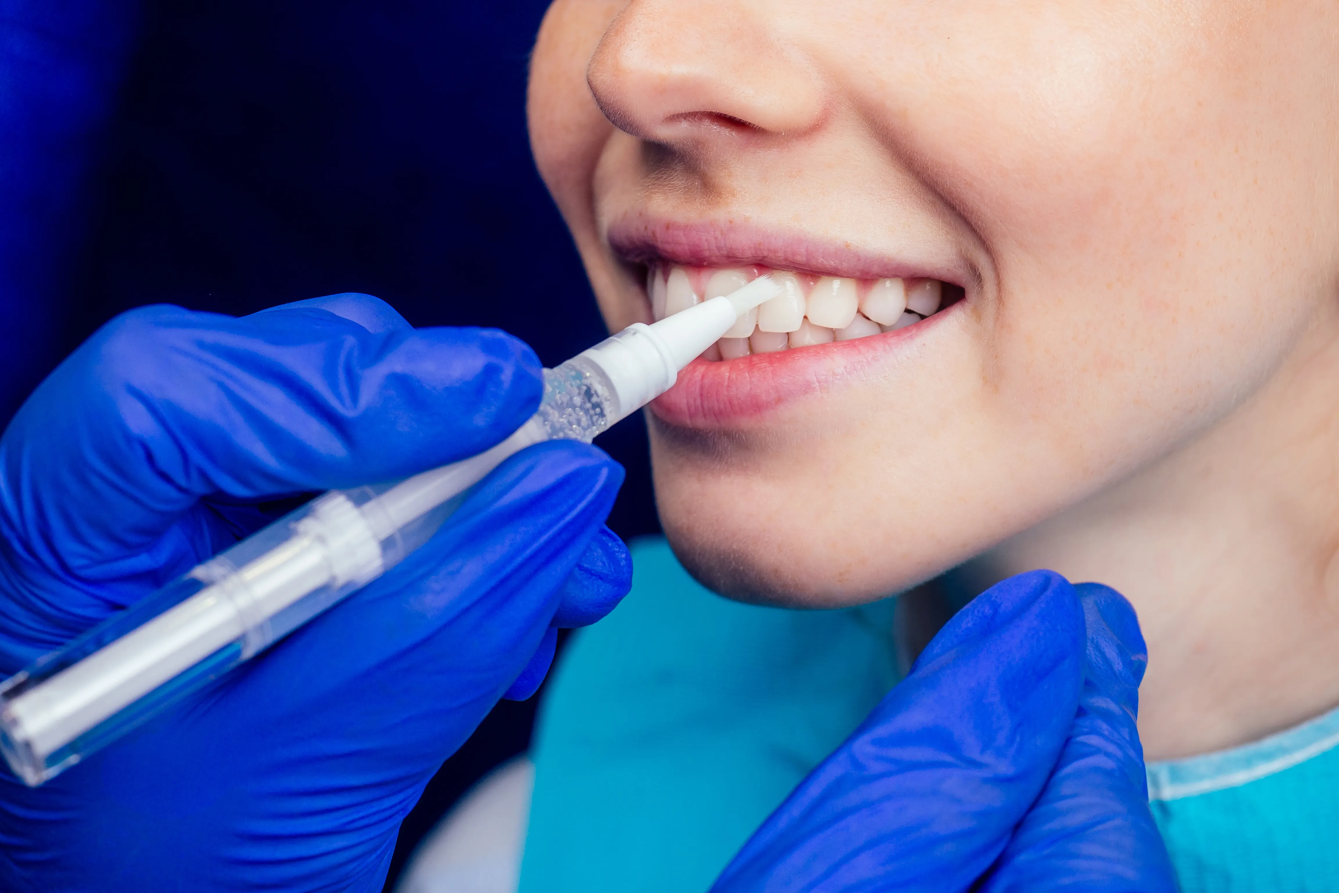A dentist applying fluoride varnish to a patient's teeth