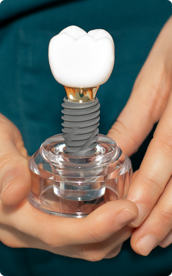 A dental implant with its custom crown restoration