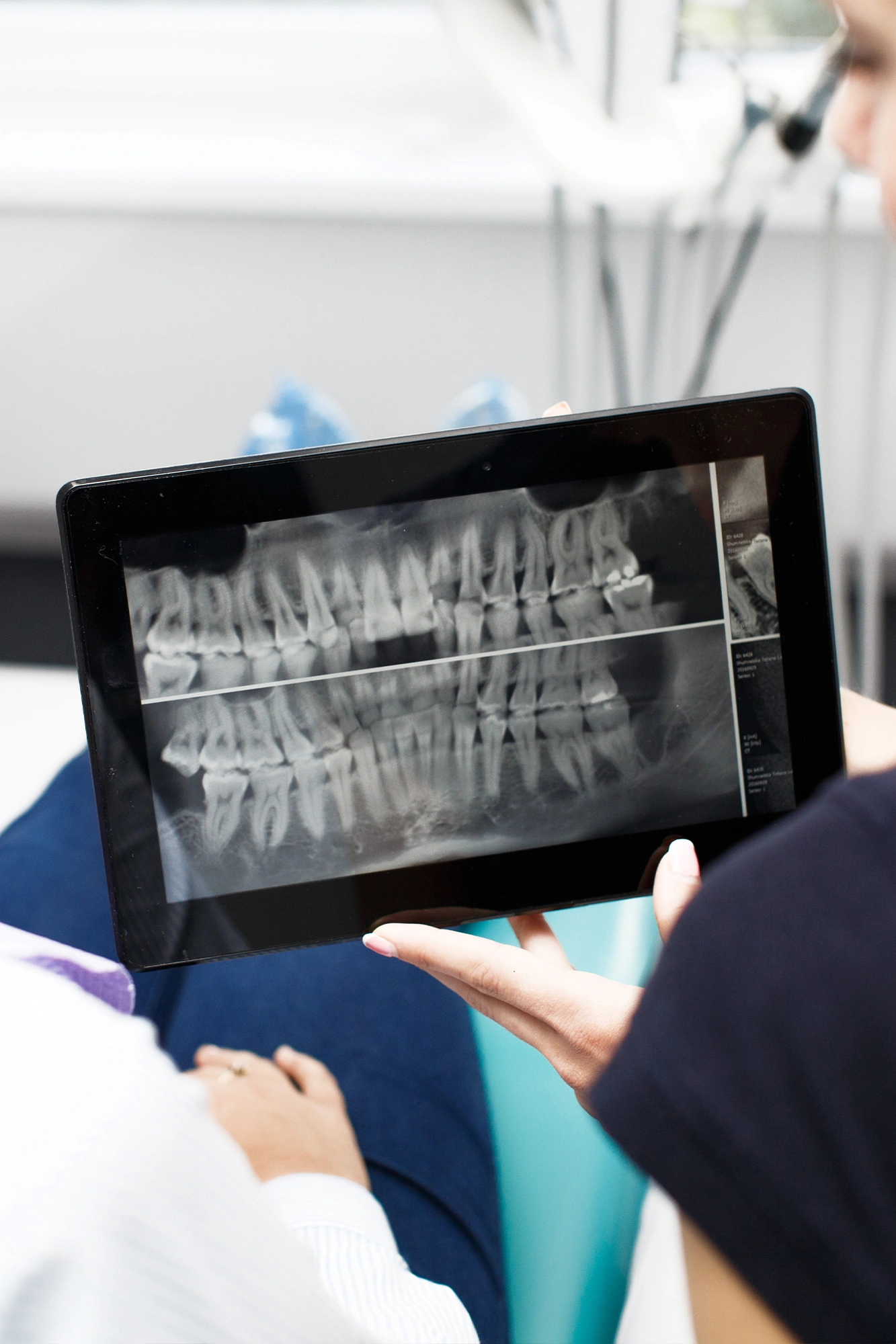 A low-radiation digital dental X-ray of a child's developing teeth