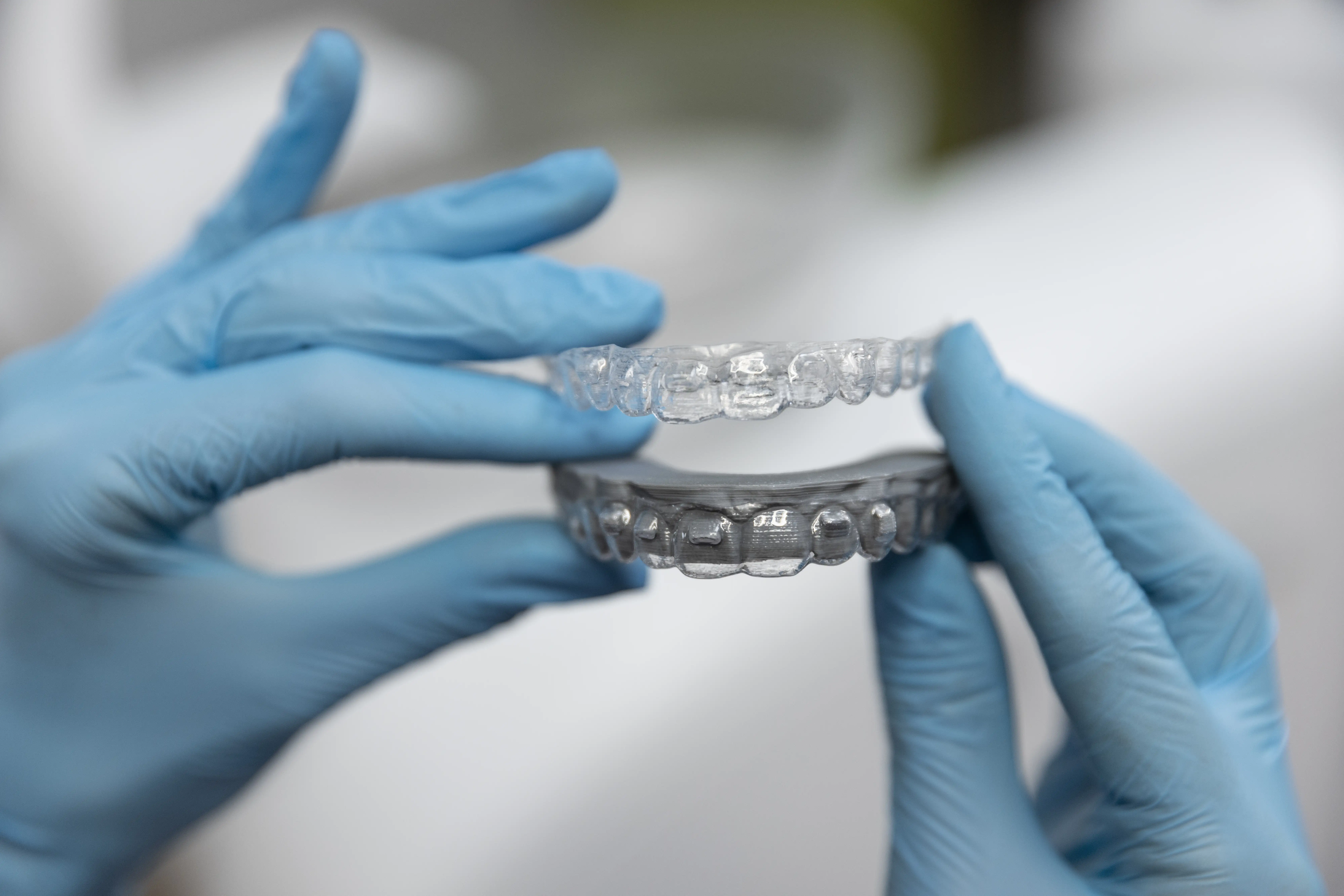  A custom-fitted dental nightguard for bruxism