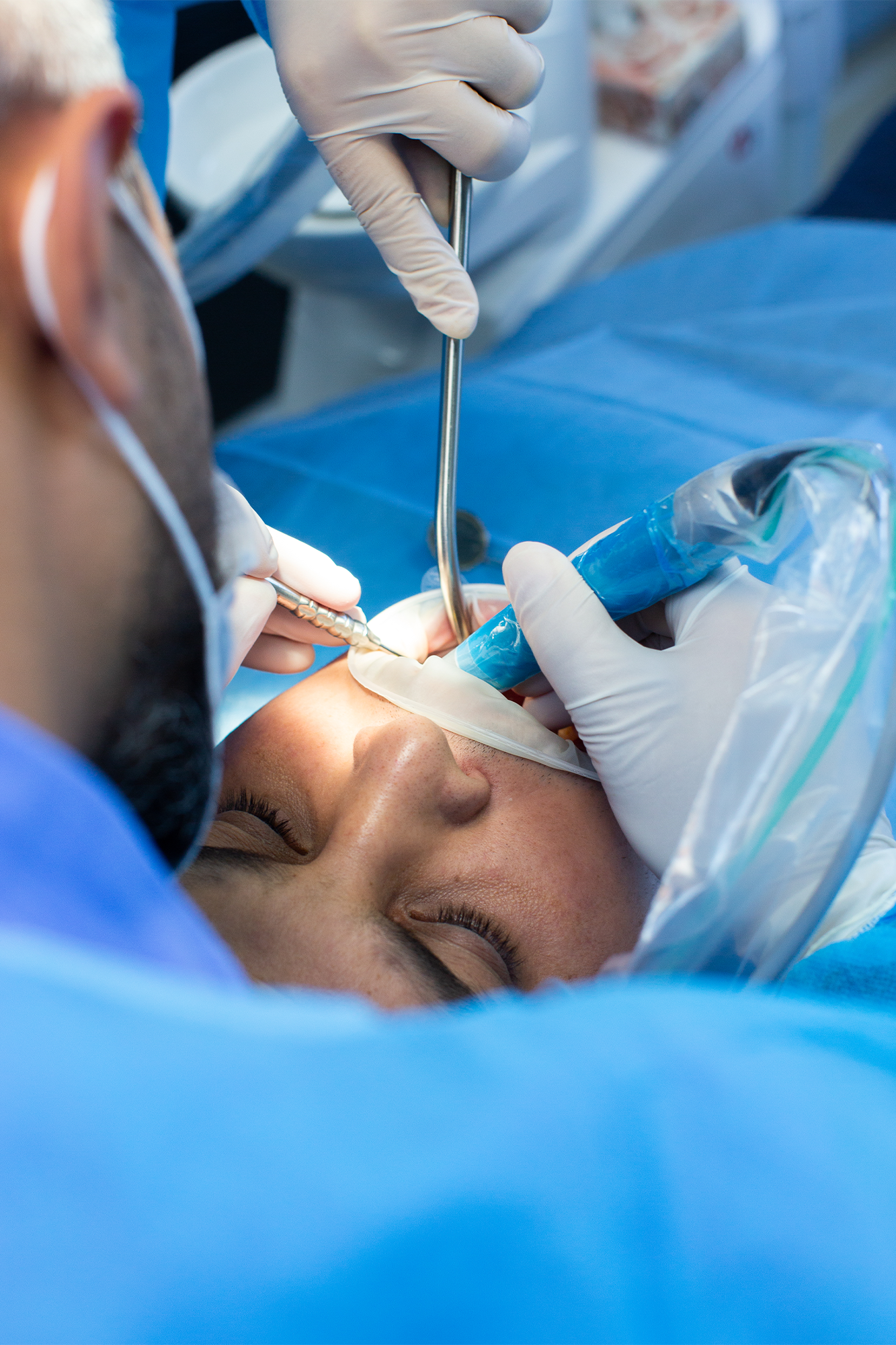 A gentle, simple tooth extraction