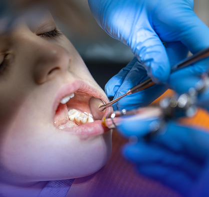 A child receiving preventive fluoride treatment