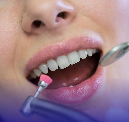 Porcelain Restorations