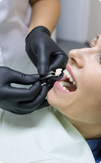 A tooth-colored ceramic crown milled in-office