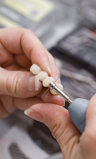 A tooth-colored ceramic crown milled in-office