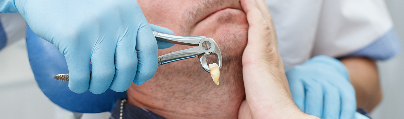 A gentle tooth extraction consultation at Dentistry at Millennium Park