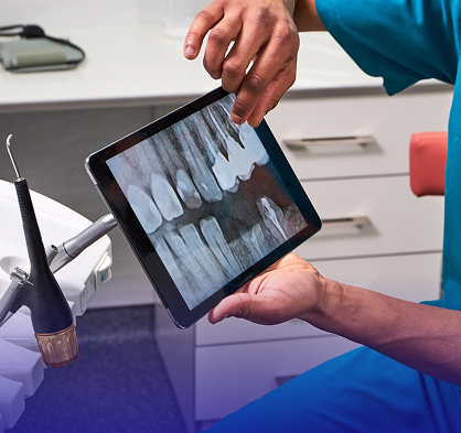 A digital dental X-ray on a monitor