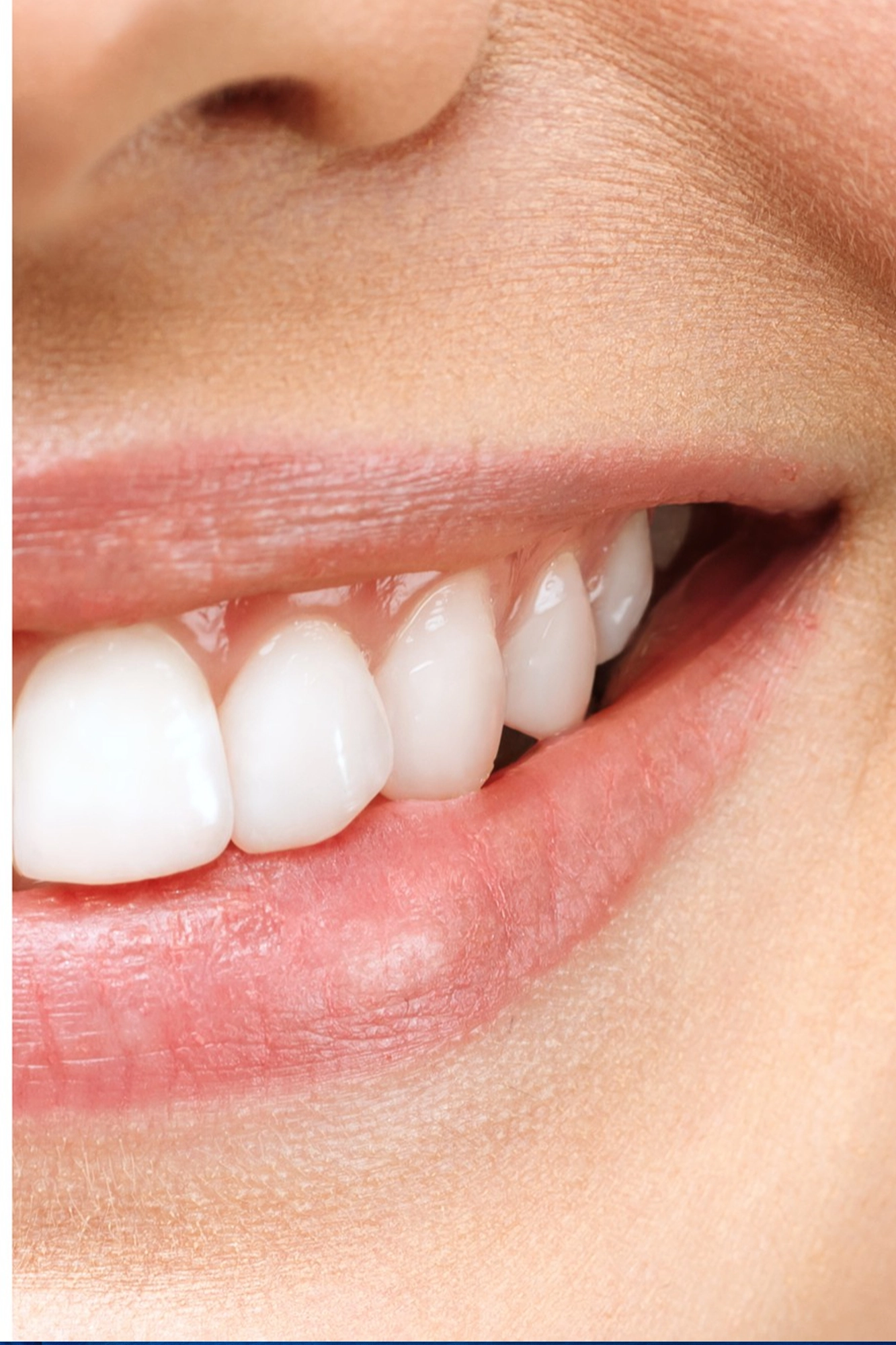 Professional teeth whitening treatment in a Chicago dental office